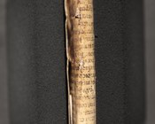 Secreti e remedi per diverse malattie del corpo umano e delle bestie